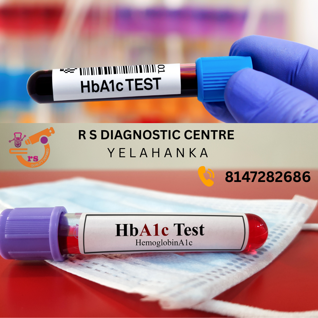 HBA1C TESTS IN YELAHANKA