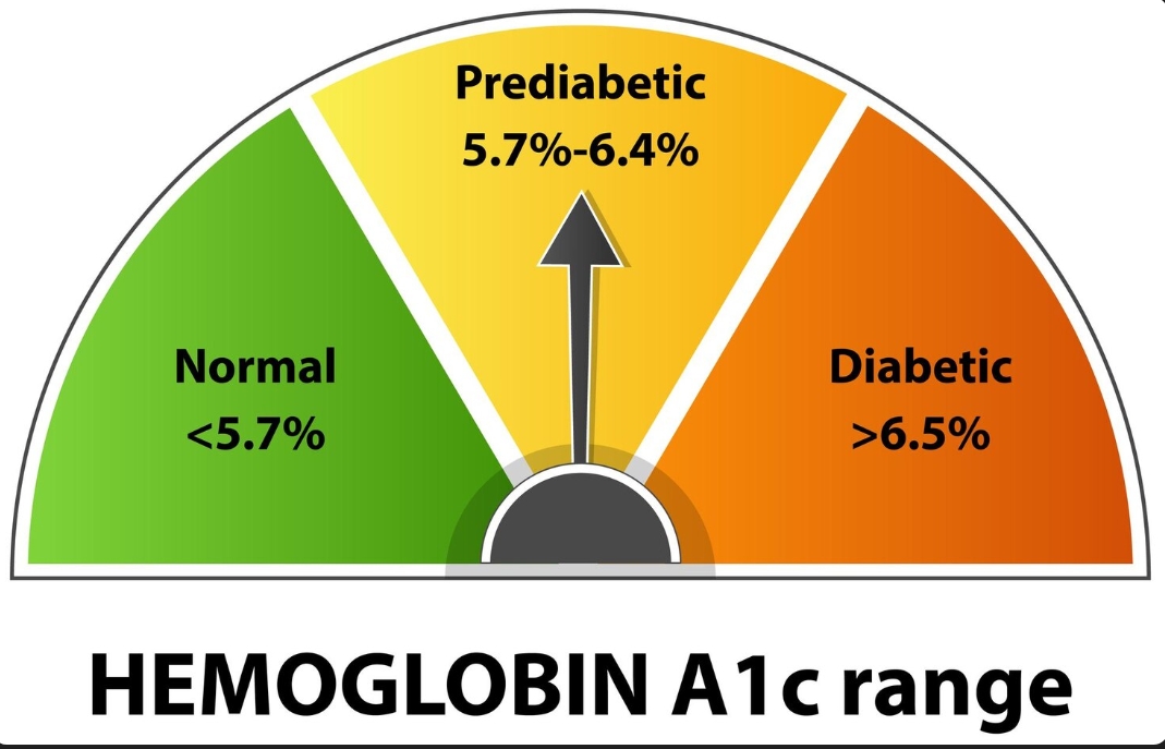LIPID PROFILE TEST