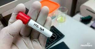 Book Tissue Transglutaminase TTG Antibody IgA Test