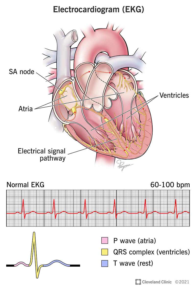 HEART DISEASES AND STROKES